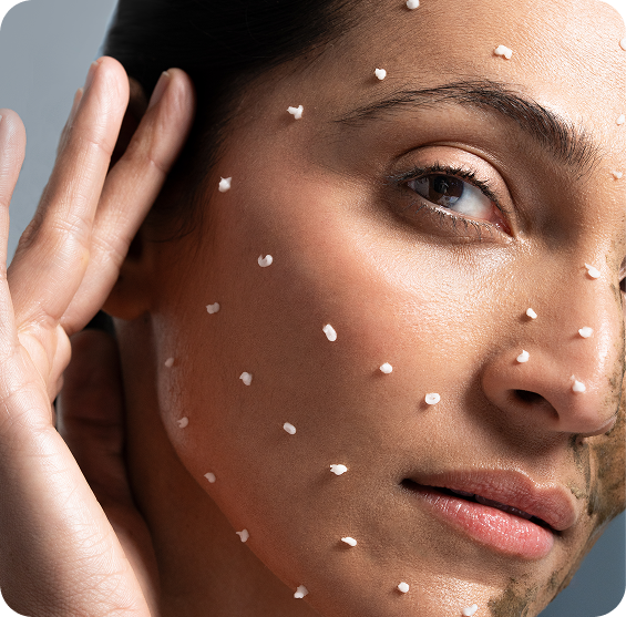 What is a Spicule Treatment?