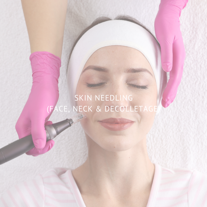 Skin Needling - Face, Neck and Decolletage