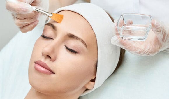 Facial Peels